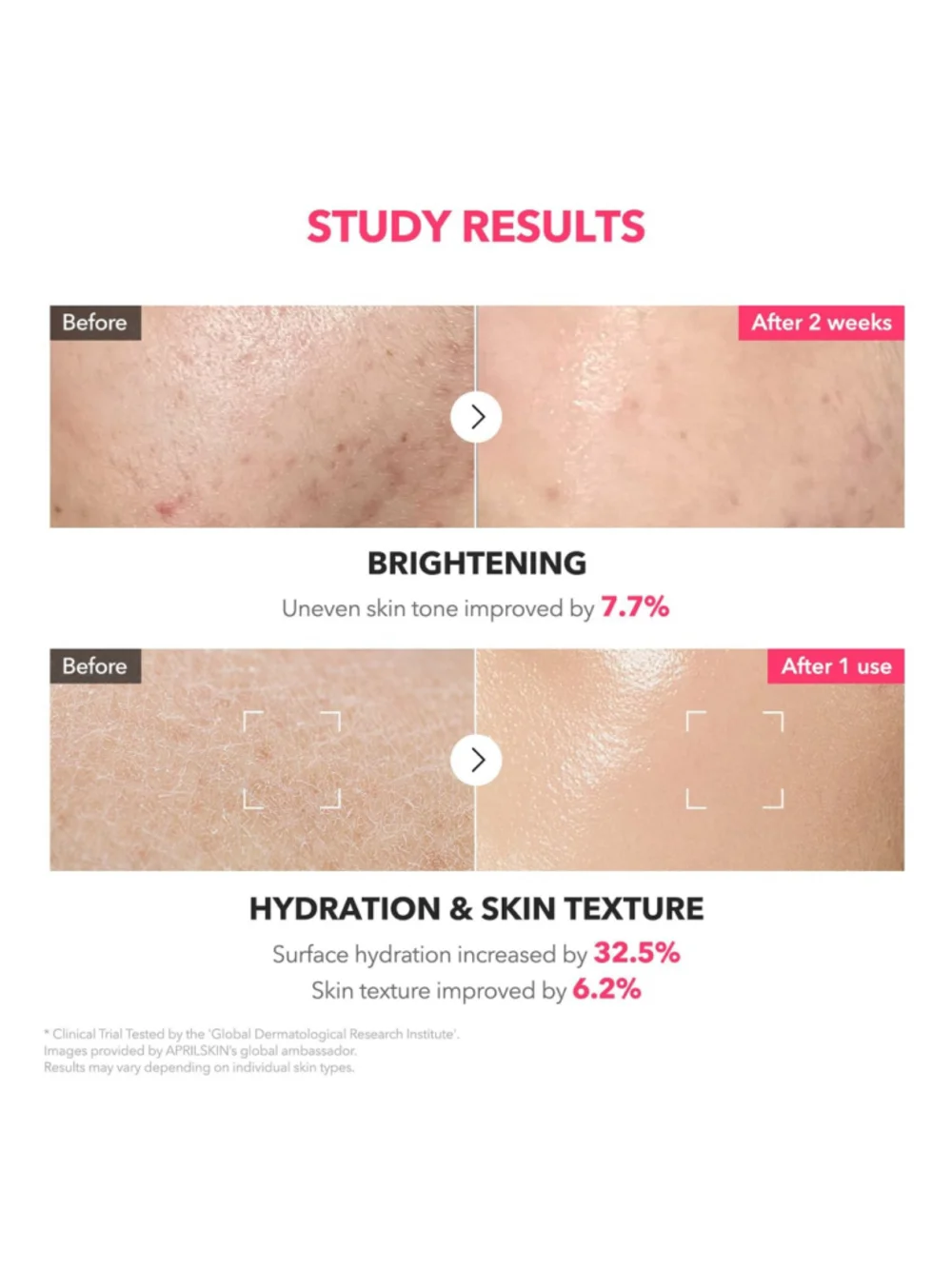 APRILSKIN TXA+Niacinamide 99 2-In-1 Pink Milky Toner